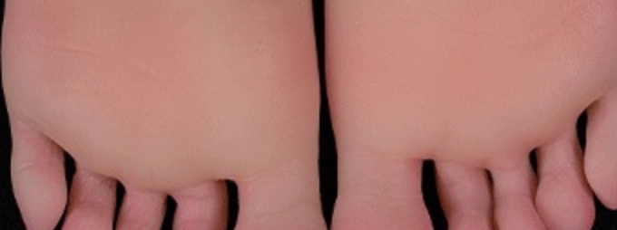 TPE: sole and toe detail